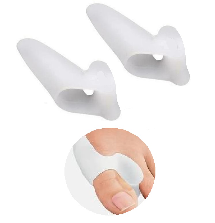 diorthotis_kotsi_xosm-ra